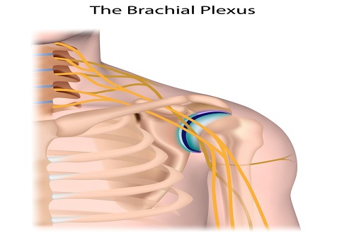Brachial Plexus Yaralanmaları ve Tedavisi